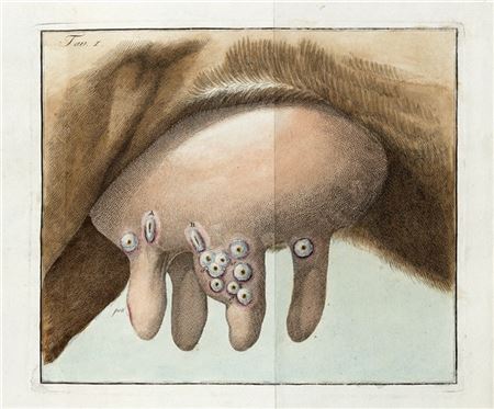 SACCO, Luigi (1769-1836) - Trattato di vaccinazione con osservazioni sul giavar