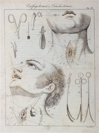 Chirurgia - Fabrici  D' Aacquapendente, Girolamo - Velpeau, Alfred Armand Louis  Marie - Opera chirurgica. Quorum pars prior Pentateuchum chirurgicum, posterior operationes chirurgicas contineOpera chirurgica 