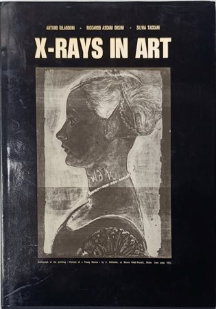 X-rays in art, Arturo Gilardoni