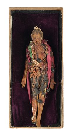 Napoli, fine XIX primi anni del XX secolo, Cadavere in decomposizione. 1910....