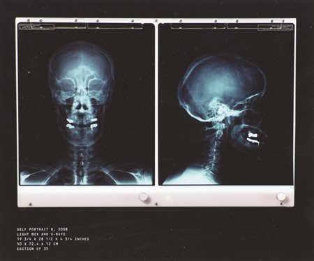 Damien Hirst, Self Portrait X-Ray, 2008, radiografia, 21,5x25,5, opera...